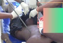Hôpital Laquintinie : un jeune homme échappe à la mort grâce à une intervention chirurgicale d’exception